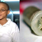 Niño dominicano se traga un pito y se salva de milagro