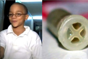 Niño dominicano se traga un pito y se salva de milagro