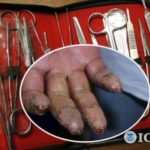 Médico dominicano confiesa borró huellas dactilares a 55 criminales en Massachusetts