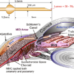 Científicos de EE UU, Francia y RD logran un implante ocular para curar el glaucoma