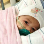 Cirujanos corrigen malformaciones congénitas de la bebé Astrid Montero