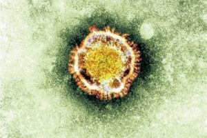 Primer contagio local del nuevo coronavirus en EEUU