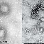 Publican primeras imágenes del mortal coronavirus proveniente de China