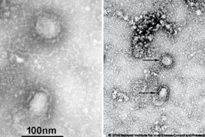 Publican primeras imágenes del mortal coronavirus proveniente de China