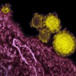 Más de 3 millones de casos de Coronavirus detectados en el mundo