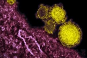 Más de 3 millones de casos de Coronavirus detectados en el mundo