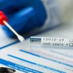 Casos de Coronavirus alcanzan los 2,088 este fin de semana, con reporte de 499 de este domingo